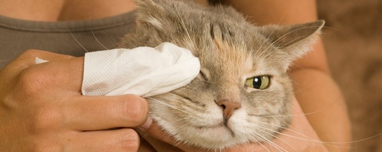 Para curar la inflamación del ojo se recomienda la limpieza con suero